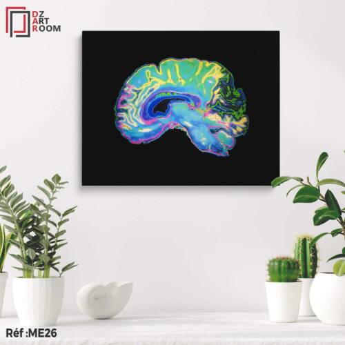 Tableau Cerveau ME26