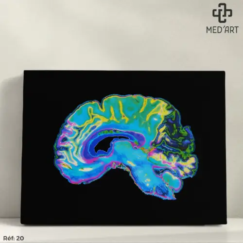 Tableau Cerveau 20