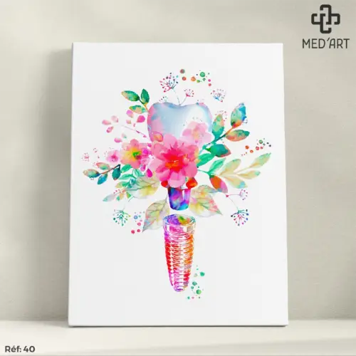 Tableau Implant Dentaire 40