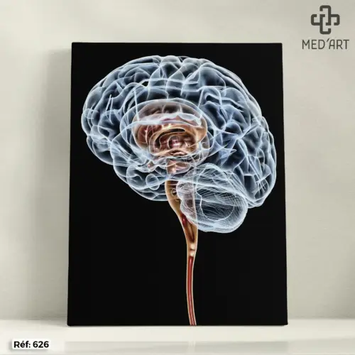 Tableau Encephale 626