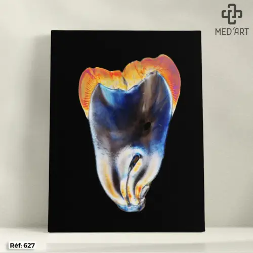 Tableau Molaire (Dent) 627