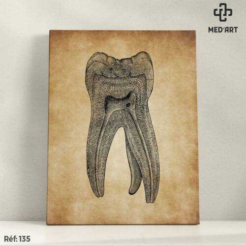 Tableau Molaire (Dent) 135