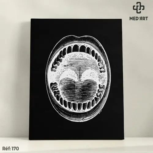 Tableau Illustration Bouche Ouverte 170