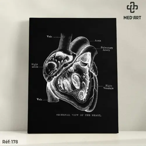 Tableau Section Transversale du Coeur 178