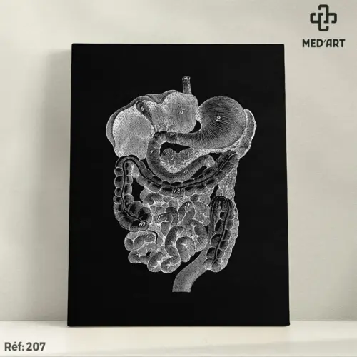 Tableau Cavité Abdominale 207