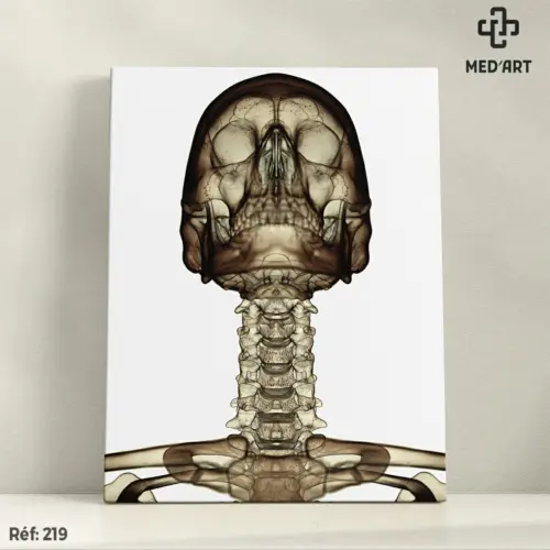 Tableau Radiographie Cervicale de Face 219