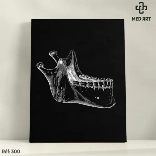 Tableau Mandibule 300