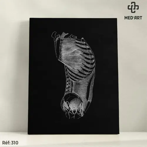 Tableau Muscle Grand Oblique 310