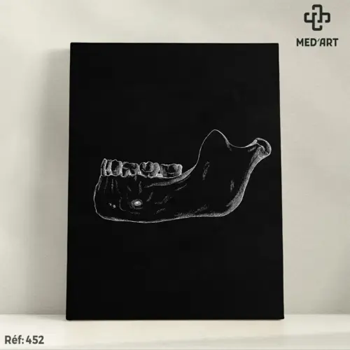 Tableau Mandibule 452
