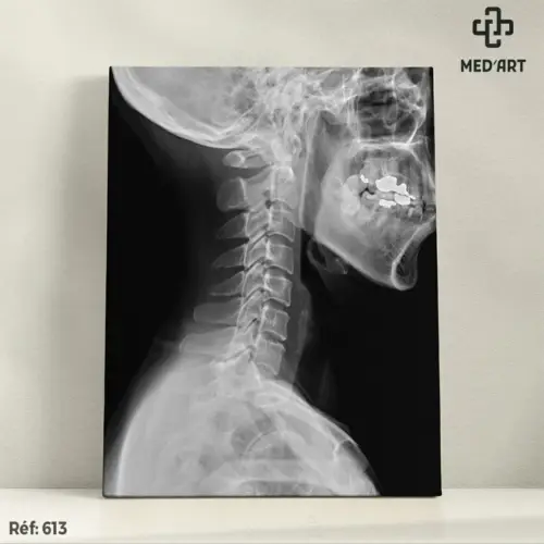 Tableau Radiographie Cervicale de Profil 613